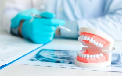 Le protesi dentarie mobili, cosa c’è da sapere a riguardo?