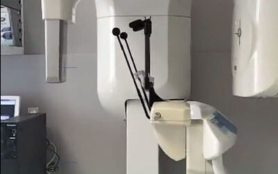 Dental Scan: un nuovo strumento a servizio dei pazienti del nostro studio dentistico